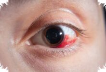 A Donor Retina Responded to Light 10 Hours After Death, Opening New Research Paths