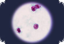 A Cyclospora Outbreak Exposed the Gaps in America’s Food Safety Defenses