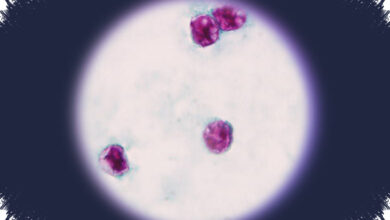 A Cyclospora Outbreak Exposed the Gaps in America’s Food Safety Defenses