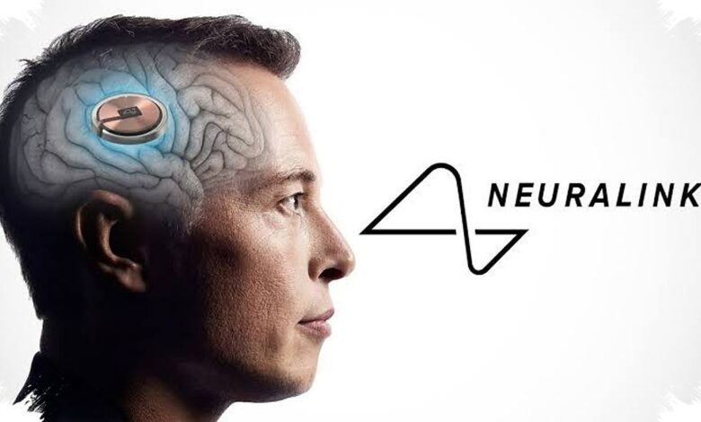 He Could Lift an Egg Without Breaking It, Thanks to an AI Brain Implant