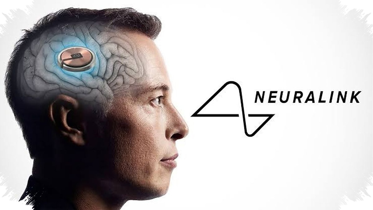 He Could Lift an Egg Without Breaking It, Thanks to an AI Brain Implant